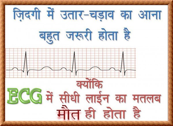 ECG Ki Line