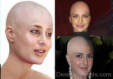 Bald Girls Of Bollywood